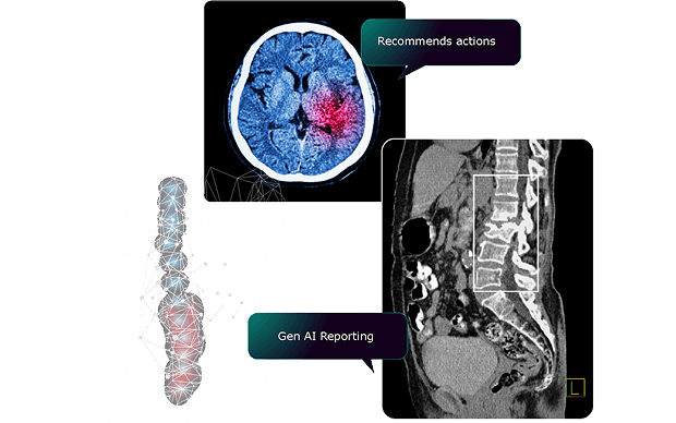 DetectCT Anatomical Detection