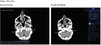 Brain CT Analysis Visualization