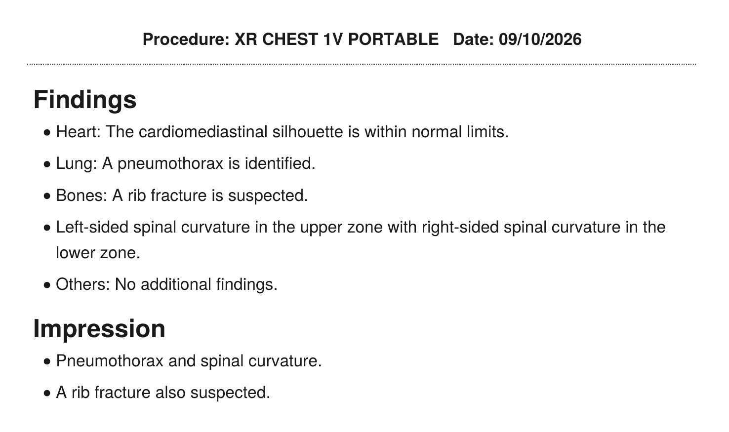 AI-drafted chest X-ray report with findings for heart, lungs and bones and an impression, ready for the radiologist to edit and sign.